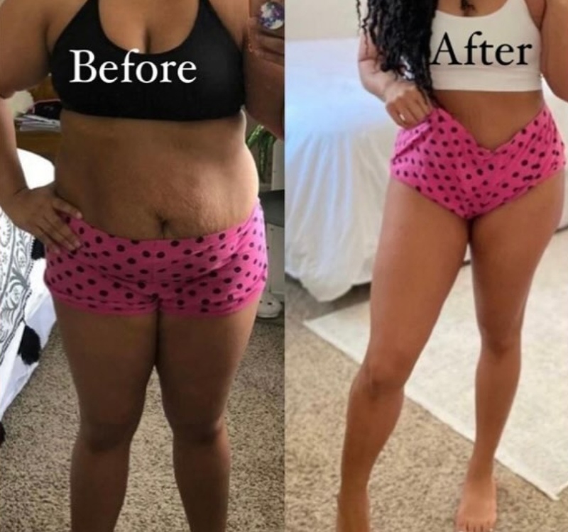 Lipolysis Injections

 | VitaGlow Oasis